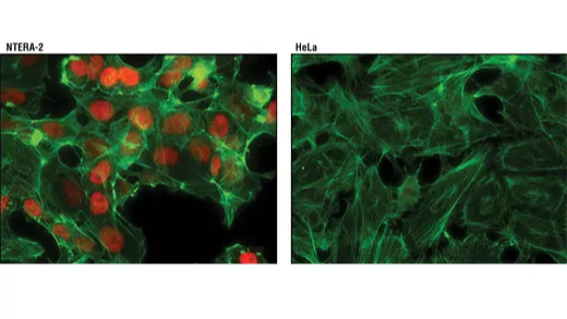 对 NTERA-2 和 HeLa 细胞进行免疫荧光分析。